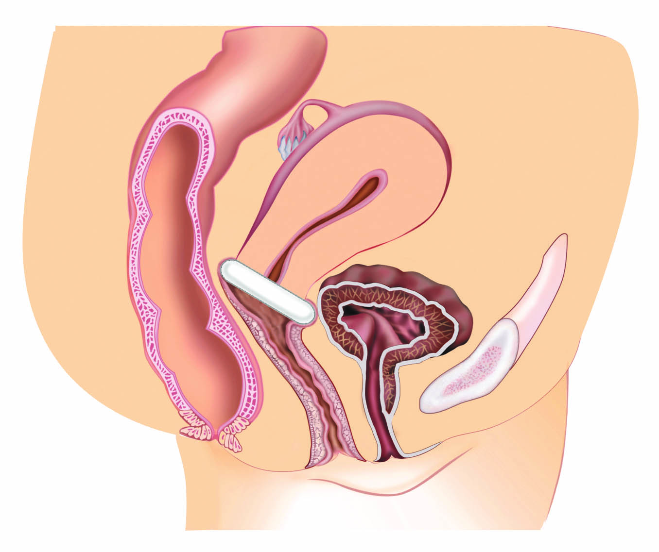 Current hormonal therapies for vulvovaginal